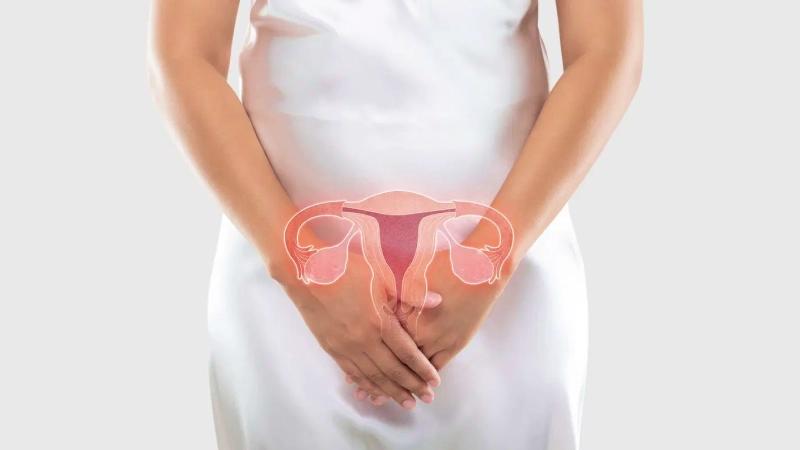 pcos چیست