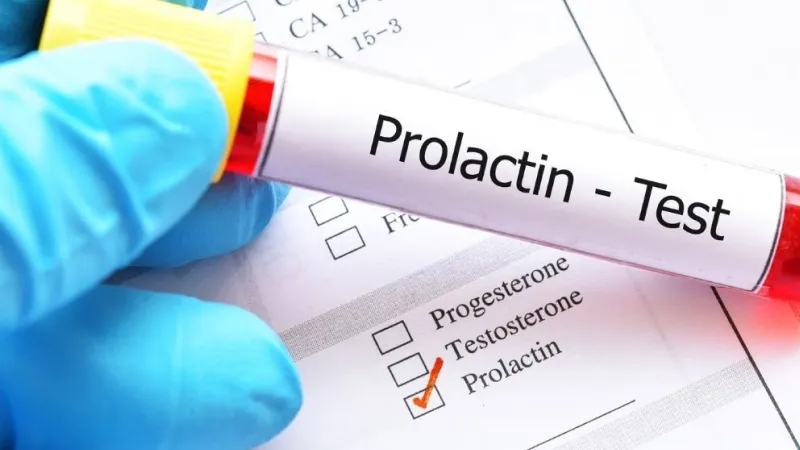 هورمون پرولاکتین چیست و مقدار بالای آن چه عوارضی دارد؟