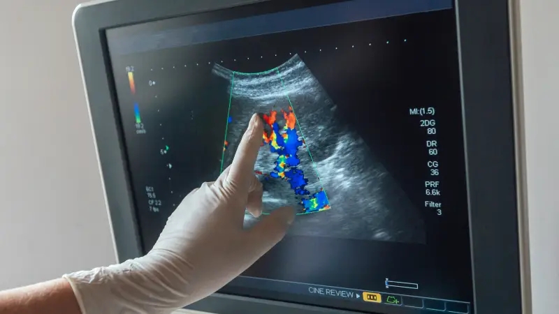 عکس رنگی رحم چیست؛ بررسی تفسیر و عوارض آن