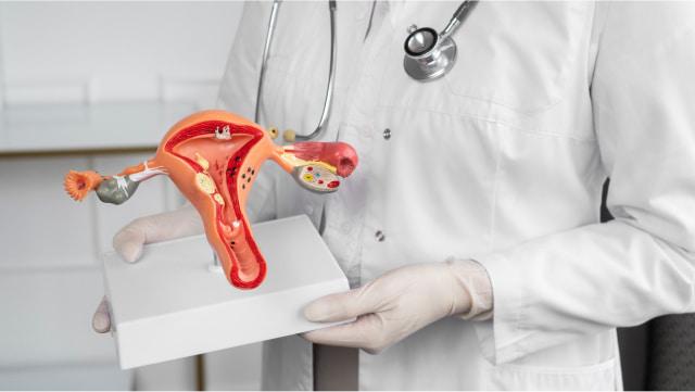علائم تنبلی تخمدان چیست؟ علل و درمان تنبلی تخمدان در خانه