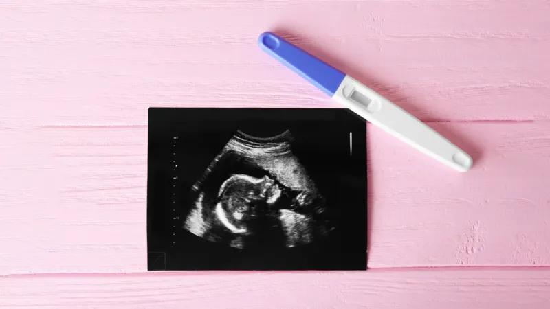 آی یو آی چیست