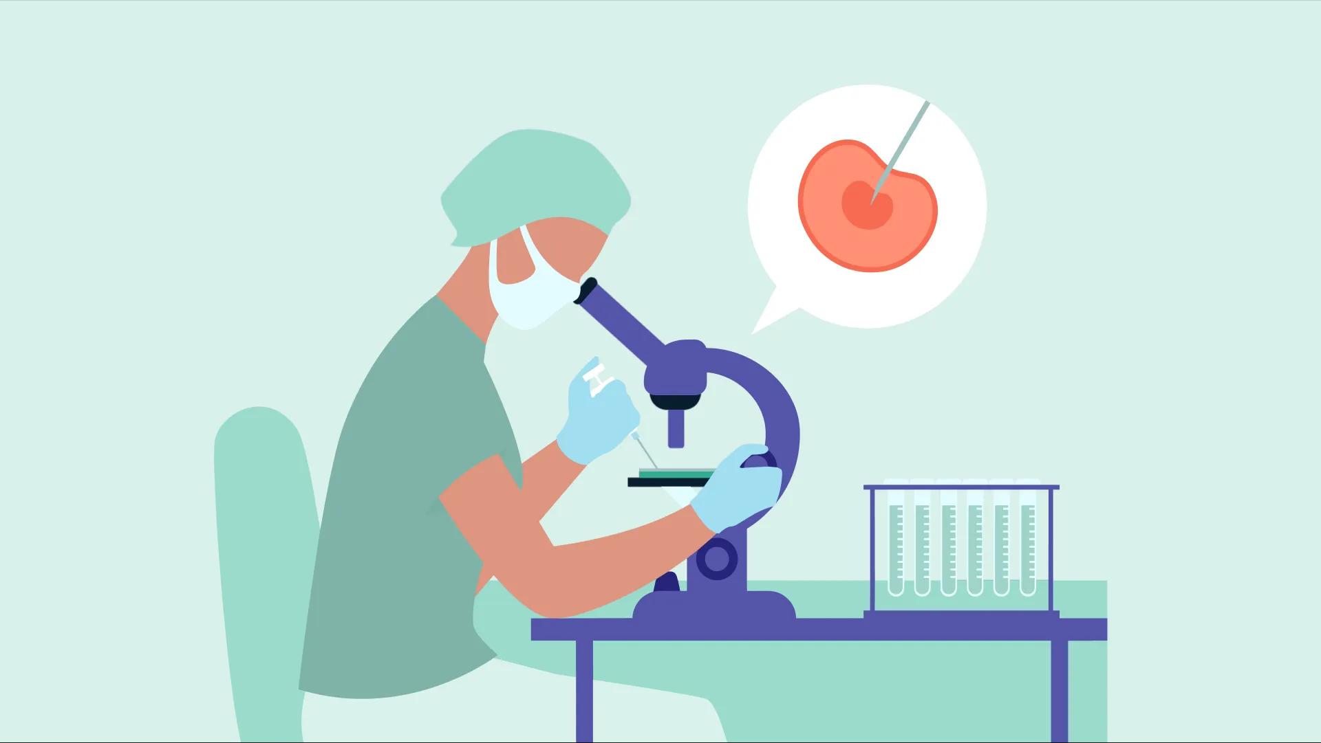 ivf چیست