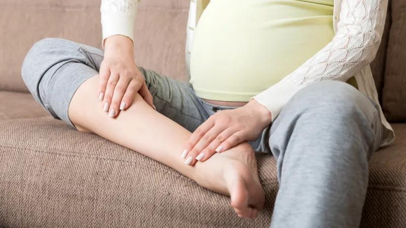 ورم پا در بارداری