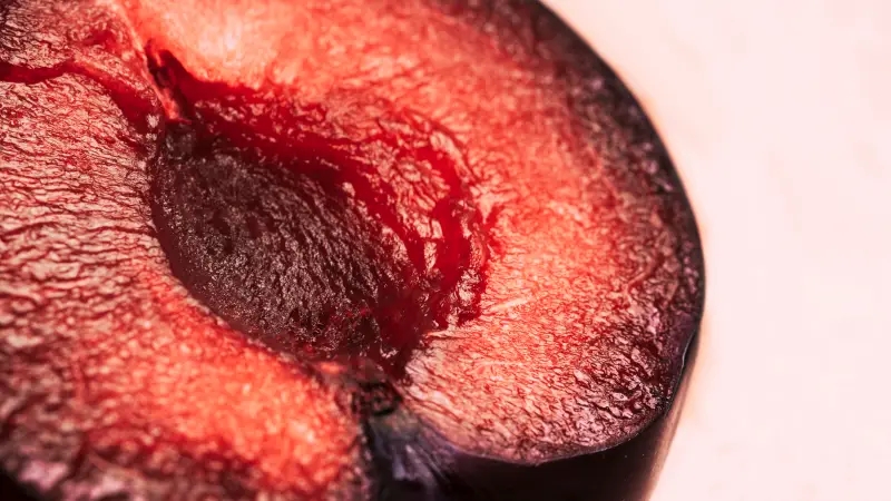 همه چیز درمورد زخم دهانه رحم؛ از درمان خانگی و دارویی تا علل!