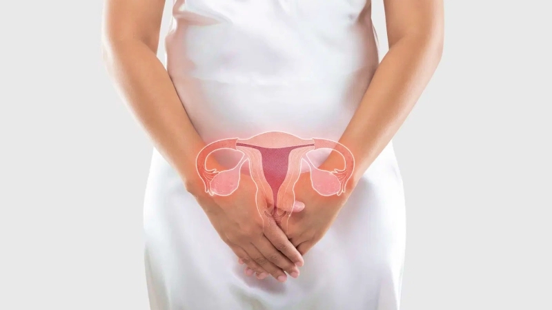 pcos چیست؟ همه چیز در مورد تخمدان پلی کیستیک